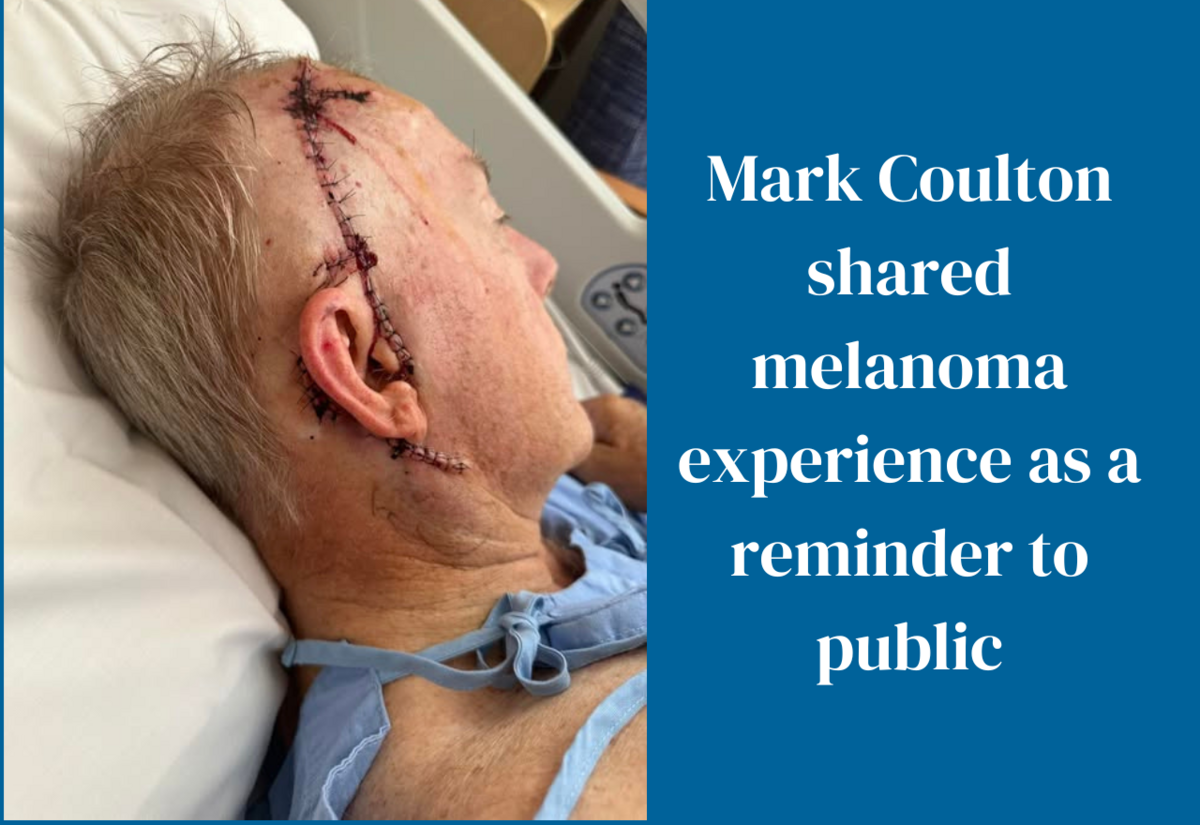 Coulton uses melanoma experience as reminder to others