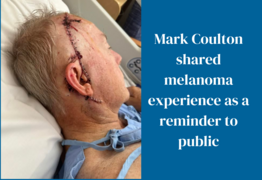  Coulton uses melanoma experience as reminder to others