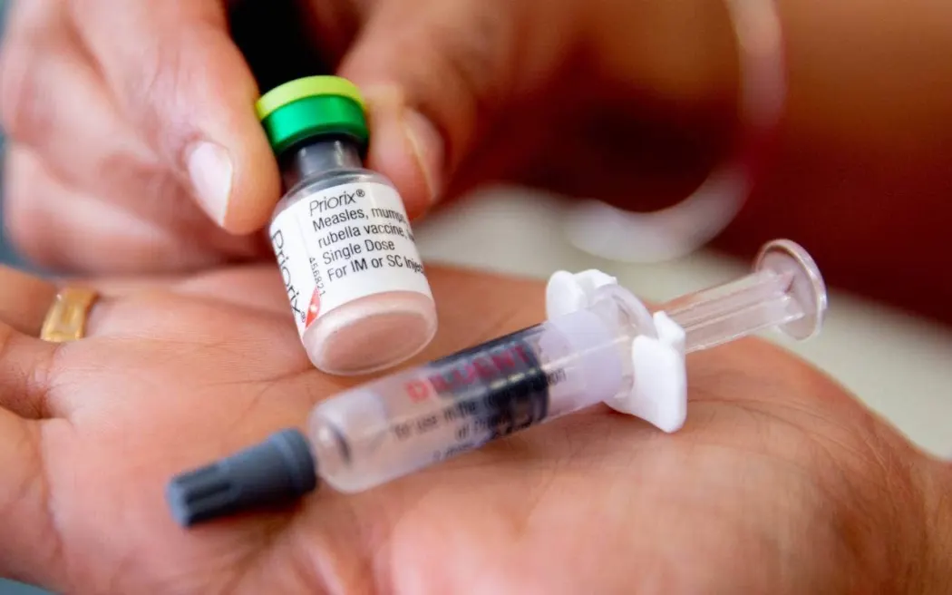 Hospitals, clinics not equipped for measles outbreak