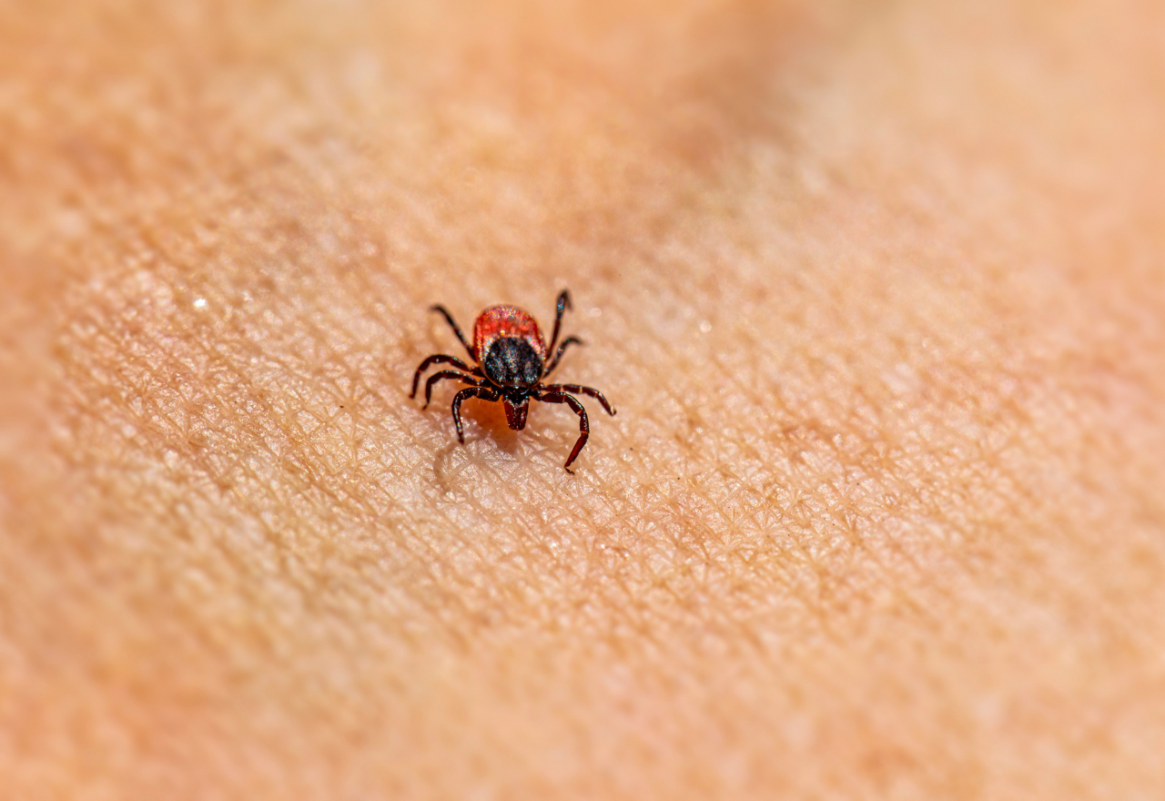 Residents urged to protect against tick bites after hospitalisations